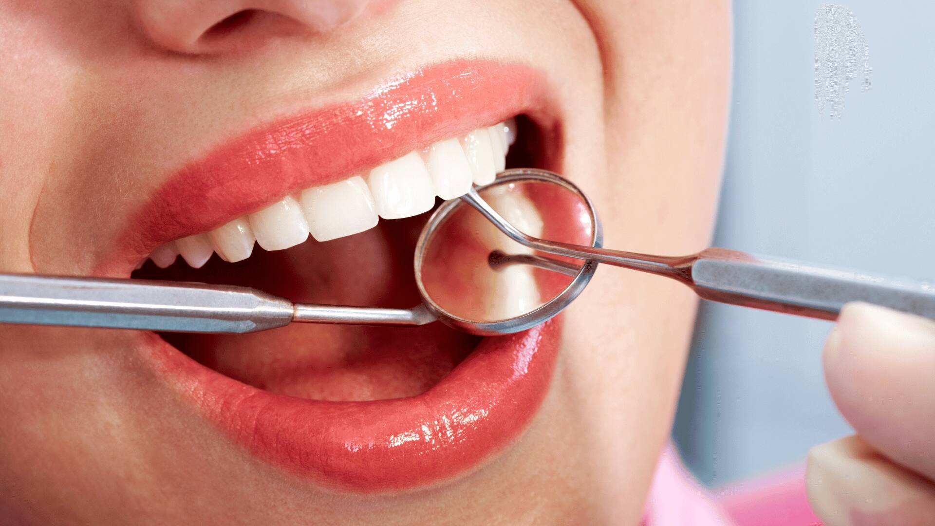 Onde Fazer Lentes de Contato Dental em Porto Alegre